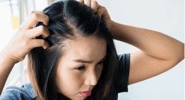 Why Ongoing Hair Loss Related to Hereditary