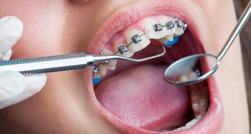Signs You’re a Good Candidate for Orthodontics